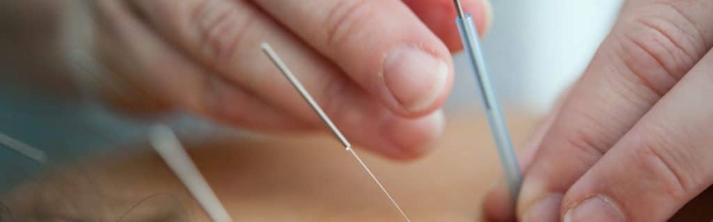 portland acupuncture laurelhurst chiropractic
